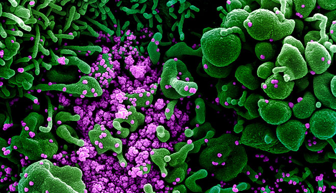 Kolorierte Aufnahme, die durch ein Rasterelektronenmikroskop erstellt wurde, einer apoptotischen Zelle (grün), die stark mit SARS-COV-2-Viruspartikeln (violett) infiziert ist, isoliert von einer Patientenprobe. Foto: NIAID Integrated Research Facility (IRF), Fort Detrick, Maryland (USA) / Wikipedia (https://de.wikipedia.org/wiki/Datei:Novel_Coronavirus_SARS-CoV-2_(49666286236).jpg) /Flickr (https://www.flickr.com/photos/niaid/49666286236/)