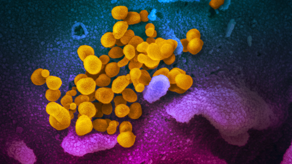 Elektro-Mikroskopische Aufnahme des Coronavirus SARS-CoV-2 (gelb), umgeben von weitere Zellen (blau und pink).Foto: NIAID Integrated Research Facility (IRF), Fort Detrick, Maryland (USA) / Wikipedia (https://de.wikipedia.org/wiki/Datei:SARS-CoV-2_(yellow).jpg ) /Flickr (https://www.flickr.com/photos/niaid/49531042877 )