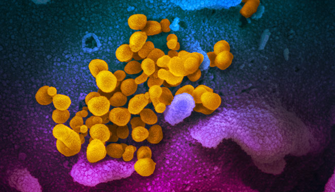 Elektro-Mikroskopische Aufnahme des Coronavirus SARS-CoV-2 (gelb), umgeben von weitere Zellen (blau und pink).Foto: NIAID Integrated Research Facility (IRF), Fort Detrick, Maryland (USA) / Wikipedia (https://de.wikipedia.org/wiki/Datei:SARS-CoV-2_(yellow).jpg ) /Flickr (https://www.flickr.com/photos/niaid/49531042877 )